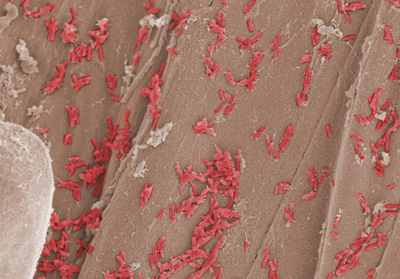 Deep Dive: Bacillus as a Multitool for Modern Ag